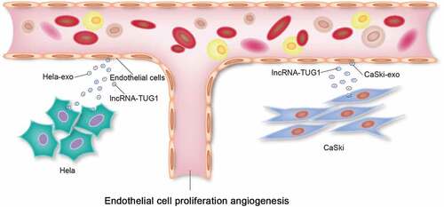 Figure 5. Graphical abstract. Cervical cancer cells (HeLa, CaSki) transfer lncRNA TUG1 to the receptor HUVECs (human umbilical vein endothelial cells) via exosomes (HeLa-Exo, CaSki-Exo), thereby enhancing HUVEC’s proliferation and angiogenesis.