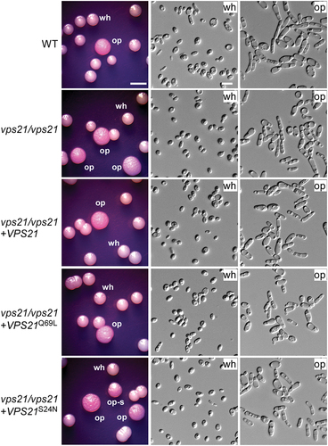 Figure 1. Function of Vps21 and its variants in the regulation of white-to-opaque switching. White cells of the WT control, vps21/vps21 mutant, and reconstituted strains were initially grown on Lee’s glucose medium (pH 6.8) at 25 °C for 7 days. Candida albicans cells of homogeneous white colonies were replated onto Lee’s GlcNAc medium (pH 6.8) and incubated at 25 °C for 5 days. wh, white; op, opaque; op-s, opaque-sectored (colonies containing both white and opaque cells). Scale bar for cells, 10 μm; Scale bar for colonies, 2 mm. Strains used: WT (FDZF208); vps21/vps21 (FDZF263); vps21/vps21 + VPS21 (FDZF489); vps21/vps21 + VPS21S24N (FDZF475); and vps21/vps21 + VPS21Q69L (FDZF473). The mating type of all strains used was MTLa/Δ. The switching frequencies are presented in Table 1.