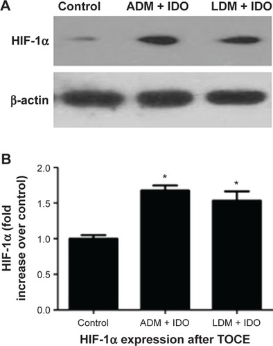 Figure 4 Western blot analysis of HIF-1α expression in rabbit liver tissue.