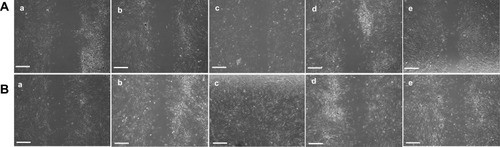 Figure 5 Wound healing effect on HDFa cells after (A) 24 h and (B) 48 h of treatment in (a) negative control, (b) silver nitrate, (c) Rifampicin, (d) MA-extract, (e) MA-AgNPs by the cell scratch assay at 10x magnifications (scale bar: 200 µm).