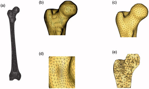 Figure 3. Mesh generation for femur. (a) Simplified model, (b) Partial model, (c) Surface mesh model, (d) Mesh refinement and (e) Body mesh model.