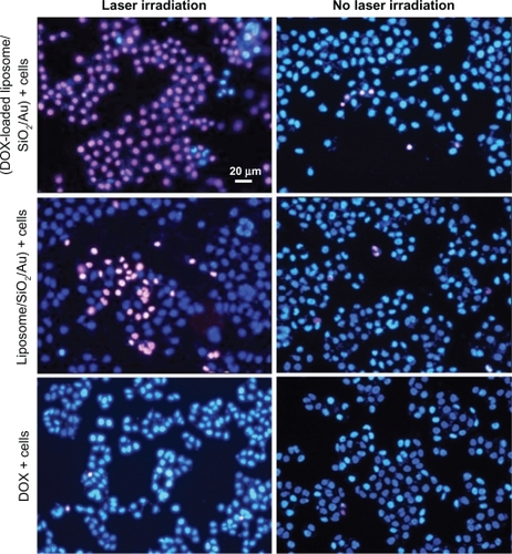 Figure 8 Fluorescence images of the SMMC-7721 cells incubated with DOX-loaded liposome/SiO2/Au, liposome/SiO2/Au, and DOX for 1 hour with 808-nm laser irradiation for 15 minutes and without laser irradiation.Abbreviation: DOX, doxorubicin.
