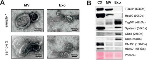 Figure 1. Isolation of MV from peripheral blood. (a) Isolated MV and Exo from two donor samples were visualised by electron microscopy (TEM) revealing two morphologically different vesicle populations. (b) Representative western blot of at least three independent samples for common vesicle markers. CX = whole cell lysate from HeLa cells.