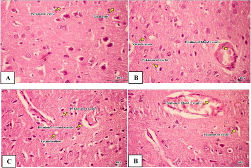 Figure 4. Light micrograph of brain of male rats. Control group (a) showed normal glial. Iron oxide nanoparticles group (b) revealed pericellular edema, dilation of blood vessels, vacuolization and pyknosis of nuclei. Silver nanoparticles group (c) revealed mild neuronal degeneration and pyknotic nuclei, pericellular edema, dilation of blood vessels and neuronal vacuolization. Combination group of iron oxide nanoparticles and silver nanoparticles (d) revealed neuronal degeneration and pyknotic nuclei, pericellular edema, dilation of blood vessels and neuronal vacuolization (H & E; X 40).