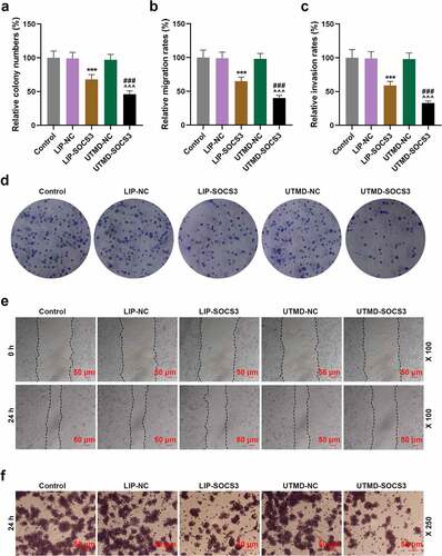 Figure 4. The effects of liposome and UTMD transfection of SOCS3 on the proliferation, migration and invasion of BCSCs. (a-c) The histogram represented the clones, migration and invasion rates of cells in the control, LIP-NC, LIP-SOCS3, UTMD-NC, UTMD-SOCS3 groups. (d) The clone formation of each group was evaluated by the clone formation assay. (e) The change of cell migration ability in each group was detected by wound healing assay (magnification × 100). (f) Transwell assay was performed to detect the invasion ability of cells in each group (magnification × 250). ***P < 0.001 vs. LIP-NC; ^^^P < 0.001 vs. UTMD-NC; ###P < 0.001 vs. LIP-SOCS3.