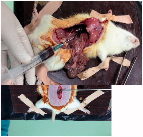 Figure 2. Blood and tissue specimens were taken by laparotomy incision.