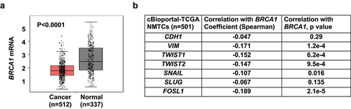 Figure 6. Analysis of BRCA1 expression and its correlation with EMT markers in human thyroid tissues and cancers. (a) Analysis of BRCA1 mRNA expression in thyroid cancer samples (Cancer) and paired normal thyroid tissues (Normal) in GEPIA (http://gepia.cancer-pku.cn) dataset. (b) Correlation analysis of mRNA expression of BRCA1 and EMT markers in thyroid carcinoma/NMTC samples (TCGA, Firehose Legacy) by cBioportal for Cancer Genomics (https://www.cbioportal.org).
