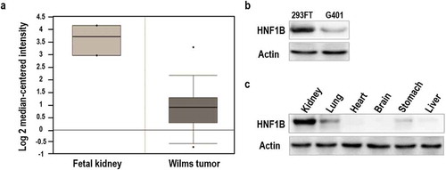Figure 1. Relative expression of HNF1β in fetal kidney and Wilms’ tumor. (a) Expression of HNF1β low in Wilms’ tumor and human Fetal kidney. (b) Expression of HNF1β in Fetal kidney cell line (293FT) and Wilms’ tumor cell lines (G401). (c) Expression of HNF1β in murine kidney tissues.