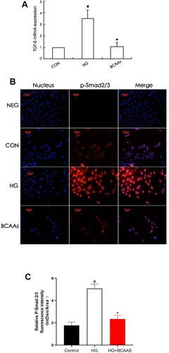 Figure 1 (A) TGF-β1 mRNA levels were assayed using semiquantitative RT-PCR assay in CON group, HG group, BCAAs group, respectively. (B) Immunoflourescence staining for p-Smad2/3 in RMCs in CON group, HG group, BCAAs group, respectively. (C) Quantification of p-Smad2/3 fluorescence intensity (integrated density per stain area). #p <0.05 vs CON group, *p <0.05 vs HG group. Data were shown as the mean ± SD, with n = 5 samples in each group.