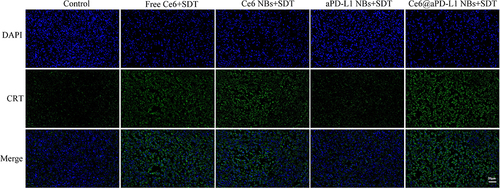 Figure 9 Analysis of CRT exposure in tumor by immunofluorescent staining. Compared with the control and aPD-L1 NBs + SDT group, CRT fluorescence signal in tumor tissue was amplified significantly. Scale bar = 20µm.