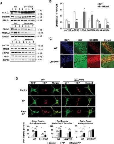 Figure 5. Impaired autophagy-lysosome function in GbaL444P/WT neurons. (A) Western blot analysis of autophagy in WT (n = 3) and GbaL444P/WT (n = 4) mouse hippocampal tissue. (B) Quantification of protein bands normalized to GAPDH showed higher levels of the autophagy proteins LC3B-II and SQSTM1, and lower levels of autophagy regulators p-MTOR, AMBRA1 and BECN1 in GbaL444P/WT compared to WT. Data represent mean ± SE from 3 independent experiments. Compared to WT, * p < 0.05; **, p < 0.01, Student’s-t test. (C) Representative micrographs for LC3B and SQSTM1 immunohistochemistry in the CA1 region of WT (n = 3) and GbaL444P/WT (n = 3) mouse hippocampal sections. Scale bar: 20 μm. (D) Representative hippocampal neurons cultured from CAG-RFP-GFP-LC3B reporter mice crossed with WT or GbaL444P mutant mice (top panels). Quantification of GFP-positive (green) and RFP-positive (red) LC3B puncta in cell bodies of primary hippocampal neurons (DIV 14–15) was used to estimate the amount of reporter LC3B protein degraded by autophagy. Neurons were treated with (PI+) and without the lysosome protease inhibitors leupeptin and pepstatin A (10 μM each) to determine the amount of reporter LC3B degraded by lysosomes. Induced autophagy was assessed by treating neurons with rapamycin (200 µM) + leupeptin and pepstatin A. Green puncta denote GFP-positive autophagosomes prior to fusion with lysosomes, and RFP-positive red puncta denote the total pool of autophagic vacuoles. The ‘Red-Green’ denotes autolysosomes, which was calculated by subtracting the number of GFP-positive from RFP-positive puncta. Data are mean ± SEM of ~40 neurons from 4–5 dishes of living neuronal cultures per condition. Compared to WT, *, p < 0.05; **, p < 0.01, One-way ANOVA, Bonferroni post hoc test. Scale bar: 10 μm.