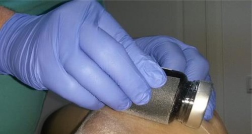 Figure 2 Picture of the method of abrasion used in the present technique.