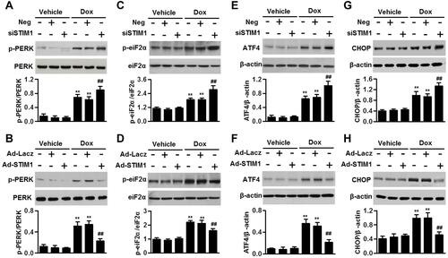 Figure 6 STIM1 downregulation potentiates Dox-induced ER stress. (A–D) AC16 human cardiomyocytes were transfected with STIM1 siRNA (40 nmol/L) (A and C), STIM1 adenovirus (40 MOI) (B and D), or their corresponding negative control, and then incubated with Dox (10 μmol/L) for 1 h. The phosphorylation of PERK (A and B) and eiF2α (C and D) were determined. (E–H) The cells were treated with STIM1 siRNA (E and G) or STIM1 adenovirus (F and H) followed by incubation with Dox (10 μmol/L) for 24 h. The protein expression of ATF4 (E and F) and CHOP (G and H) were determined. Data were represented as mean ± SEM. **P<0.01 vs vehicle; ##P<0.01 vs Dox, n=6.
