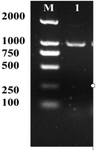 Figure 1. PCR analyses of acdS gene in B. cereus. M: DNA Marker (DL 2000); 1: 996 bp PCR products.