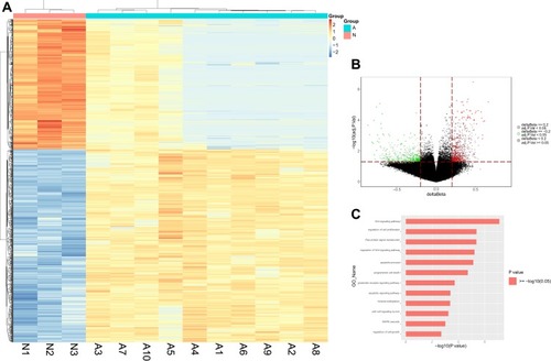 Figure 1 Differential methylation study in ten MDS patients vs 3 healthy individuals from bone marrow samples. (A) Heatmap representing a supervised cluster centred on the median of the methylation levels at the 2421 CpG sites between ten MDS patients (A) vs 3 healthy individuals (N). Samples represented as A (Salmon orange) and N samples (purple). Hypermethylated CpG probes in MDS patients (orange) and hypomethylated probes (blue). (B) Volcano plot representation of methylation for significant CpG sites of genes. Hypomethylated probes are represented in green colour and hypermethylated probes are represented in red. Red lines delimit ±0.1 methylation differences between MDS patients vs healthy donors and the dotted line represents a p-value threshold of 0.05. (C) Significantly changed GOs of hypomethylated genes in MDS patients. The y axis shows category and the x axis, -LgP. The larger –LgP indicated a smaller P value.