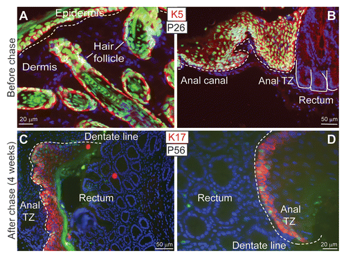 Figure 3 In vivo detection of label-retaining cells in the anorectal junction. (A–D) Anorectal sections of pTRE-H2B-GFPxK5tTA mice before (26 days old) and after 4 week chase (56 days old). Shown are epifluorescence of H2B-GFP (green) and 4′,6″-diamidino-2-phenylindole (DAPI) (blue) and indirect immunofluorescence with indicated antibodies (Rhodamine Red). (A and B) Before the chase, all Keratin 5 expressing cells and their progeny show nuclear GFP expression in the perianal skin, hair follicles (A) and anal epithelium. (B) Note that the rectum is GFP-negative. (C and D) GFP-positive cells are retained in the anal region adjacent to the dentate line (anal transition zone). Keratin 17,Citation58 is found expressed at the anal transition zone in adult mice. P26, 26 days old; P56, 56 days old; K17, Keratin 17. The asterisk denotes autofluorescence.