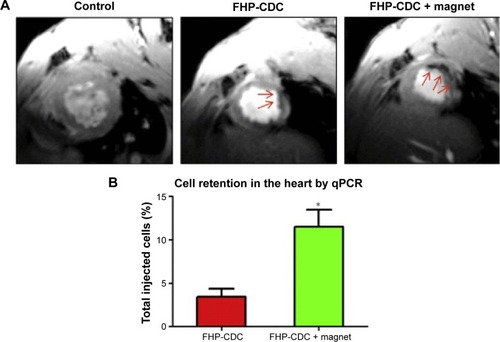 Figure 3 External magnetic targeting in an animal model of myocardial infarction.Notes: (A) T2*-weighted MR images acquired 24 hours after the induction of myocardial infarction, indicating the increased retention of ION-labeled stem cells with the help of an external magnet (FHP-CDC, signal hypointensities marked by red arrows), which was confirmed by (B) quantitative PCR. *P<0.05. Reprinted from Biomaterials, 35(30), Vandergriff AC, Hensley TM, Henry ET, et al. Magnetic targeting of cardiosphere-derived stem cells with ferumoxytol nanoparticles for treating rats with myocardial infarction, 8528–8539. Copyright 2014; with permission from Elsevier. doi: 10.1016/j.biomaterials.2014.06.031.Citation70Abbreviations: FHP-CDC, ferumoxytol-heparin-protamine labeled cardiac-derived stem cells; ION, iron oxide nanoparticle; MR, magnetic resonance; qPCR, quantitative polymerase chain reaction.