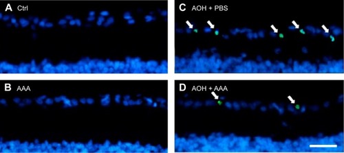 Figure 1 AAA attenuates AOH-induced retinal apoptosis.