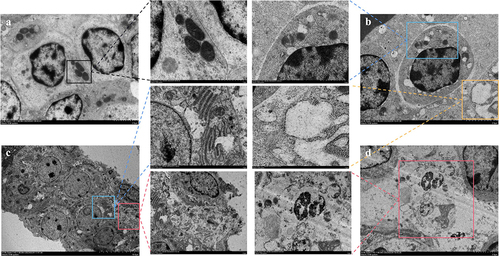 Figure 2. Shows the effect of MS-infection on ultrastructural changes in the spleen of chickens (×6,000). (A) Control group, the normal mitochondrial structure (black box) (B) MS-infection 3 dpi group, with mitochondrial swelling, cristae disorders, and vesicles (blue box); (C) MS-infection 6 dpi group with extensive formation of vesicles (yellow box); (D) MS-infection 12 dpi group, presence of apoptotic cells with nuclear lysis, cell membrane rupture, and cell necrosis (red box). (n = 3)