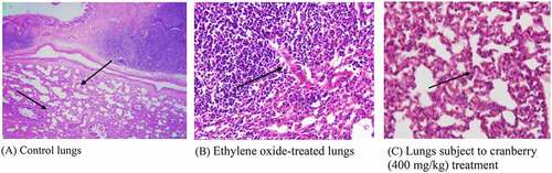 Figure 5. Histopathological examination of the lungs of rats before and after treatment with cranberry (scale bar 35 microns with 40x magnification). Changes can be observed in the architecture of connective tissues, smooth tissues and bronchioles in EtO-treated lung tissues