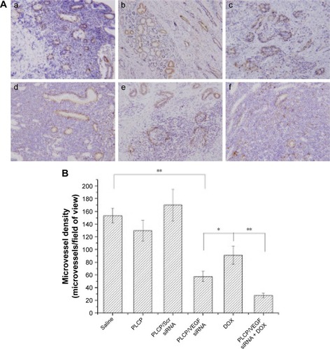 Figure 4 Determination of MVD in tumor xenograft among mice that received different treatments.Notes: (A) Immunohistochemistry images. (B) Quantitation of MVD. *P<0.05 and **P<0.01. Saline (a), PLCP (b), PLCP/Scr siRNA (c), PLCP/VEGF siRNA (d), DOX (e), and PLCP/VEGF siRNA + DOX (f).Abbreviations: DOX, doxorubicin; MVD, microvessel density; PLCP, polycation liposome-encapsulated calcium phosphate nanoparticles; Scr, scramble; siRNA, small interfering RNA.