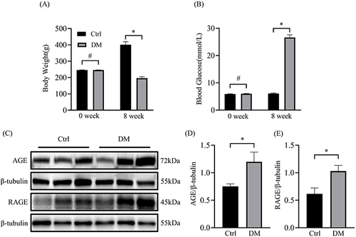 Figure 1 Body weight and blood glucose of diabetic rats and the expression of AGE and RAGE in the atrium. (A) Changes in body weight of two groups of rats in 0 week and 8 week (n=12). (B) Blood glucose changes in two groups of rats before and after modeling (n=12). (C) Representative blots of AGE and RAGE proteins in atrium of diabetic rat (n=6). (D) Densitometry analysis of AGE and RAGE proteins in atrium of diabetic rat (n=6). *p<0.05, #p>0.05.