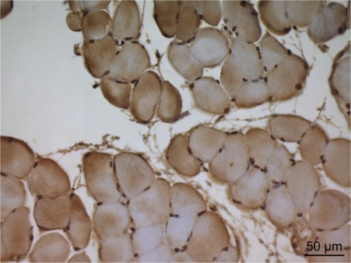 Figure 3 In the micrograph of the ischemia reperfusion group, brown staining is observed in apoptotic cell nuclei showing immunoreaction by TUNEL staining. Magnification: ×400.