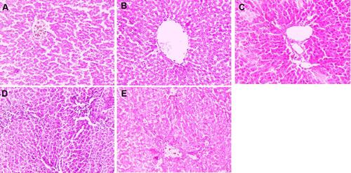 Figure 12 Effect of curcumae on the histopathology of obesity-induced hepatocellular carcinoma in rats. (A) Normal control, (B) DEN, (C) DEN + CU (2.5 mg/kg), (D) DEN + CU (5 mg/kg) and (E) DEN + CU (10 mg/kg). Tested group rats were compared with the DEN control group rats.