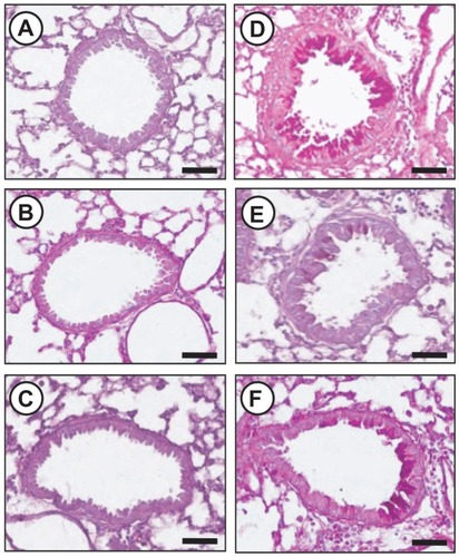Figure 6 Effect of silver NPs and SU5614 on mucus production in OVA-sensitized and OVA-challenged mice. Histological examination was obtained from lung tissue 48 hours after the final challenge in saline-inhaled mice administered saline (A), saline-inhaled mice administered 40 mg/kg of silver NPs (B), or SU5614 (C), OVA-inhaled mice administered saline (D), OVA-inhaled mice administered 40 mg/kg of silver NPs (E), or SU5614 (F). Paraffin section slide of lung tissues were stained periodic acid-schiff stain.Notes: All stained slides were evaluated via light microscopy under identical conditions with respect to magnification (20×), gain, camera position, and background illumination. Bars indicate 50 μm.Abbreviations: NP, nanoparticle; OVA, ovalbumin.
