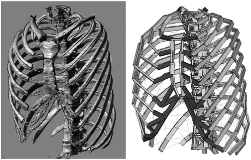 Figure 2. CT data from 16 patients (left) were transformed into 3D models consisting of beams and non-linear springs (right). See also Figure 3.