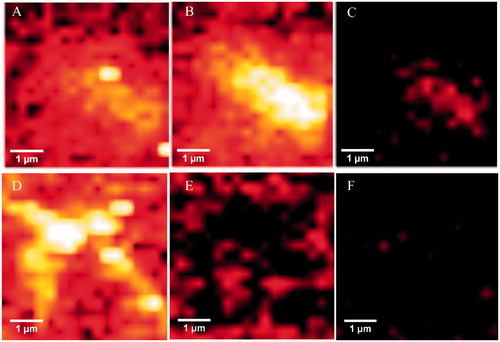 Figure 6. Upper panels: Raman maps of tau aggregation in the absence of 5 showing intensities of distinct Raman’s peaks. Images were generated from the same sample region by using the sum filter (integral) over a small window of normal modes: (A) C–H deformation 1451 cm−1 (B) Amide I-1670 cm−1) (C) Amide III-1240 cm−1. Lower panels: Raman maps taken in the same sample region) of tau aggregation in the presence of 5. (D) C–H deformation 1451 cm−1. (E) Amide I-1670 cm−1. (F) Amide III-1240 cm−1.