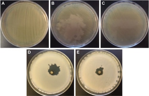Figure 10 Photographs of the Staphylococcus aureus bacteria grown on agar plates.Notes: (A) control experiment, (B) in the presence of the extract of coriander leaves, (C) in the presence of the extract of coriander seeds, (D) in the presence of sample L-0.5M, and (E) in the presence of sample S-0.5M.Abbreviations: L-0.5M, final colloid obtained using coriander leaf extract and 0.5 M AgNO3; S-0.5M, sample obtained using extracts of coriander seeds and 0.5 M AgNO3 solution.
