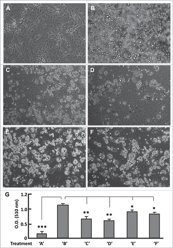 Figure 5 (See previous page). Effects of phase-specific FoxO1 inhibition on adipogenesis. (A and B) Images of cells that were maintained in basal medium (A), and that underwent differentiation induced with the protocol as described in Materials and Methods (B). (C) Images of cells that were treated with AS1842856 during stage BMII (days 7–12) and underwent differentiation induction as in (B). (D) Images of cells that were treated with AS1842856 during stage DMI (days 3–4) and underwent differentiation induction as in (B). (E) Images of cells that were treated with AS1842856 during stage BMI (days 1–2) and underwent differentiation induction as in (B). (F) Images of cells that were treated with AS1842856 during stage DMII (days 5–6) and underwent differentiation induction as in (B). The final concentration of AS1842856 was 0.1 μM. All the images were captured on day 12, and the microscope was set at 100X. (G) Measurement of extracted Oil red O retained in cells by the absorbance (O.D.) at 510 nm (n = 6). Treatments of ‘A’–‘F’ refer to the individual treatments as described in panels A-F. * P < 0 .05; **, P < 0 .01; and ***, P < 0 .0001.