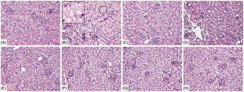 Figure 5. Renal histopathology. (A) Blank control, (B) 72 h TCE+, (C) 72 h B1RA+, (D) 72 h B2RA+, (E) vehicle control, (F) 72 h TCE−, (G) 72 h B1RA− group, and (H) 72 h B2RA− group. Magnification =200×. H&E staining. Representative photos are shown.