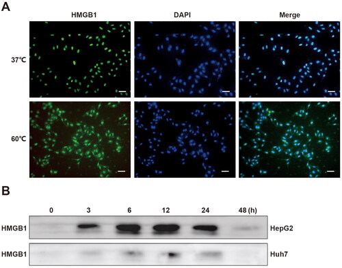Figure 2. HMGB1 was released from dead tumor cells after thermal treatment. (A) Immunofluorescence of HMGB1 was performed on HepG2 cells treated in a water bath at 60 °C or 37 °C, Scale bars, 50 µm. (B) Western blot analyses were performed on HMGB1 in the supernatant of HepG2 and Huh7 cells at 0, 3, 6, 12, 24, and 48 h after thermal treatment at 60 °C.
