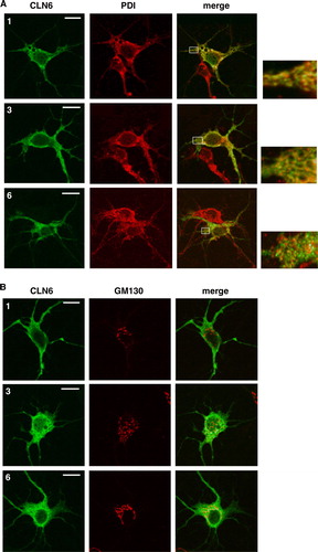 Figure 6.  Localization of wild type and mutant CLN6 forms in hippocampal neurons. Mouse hippocampal primary neurons were transfected with CLN6 cDNAs encoding wild type (1) or p.Glu2_Phe49del (3) and p.Glu225X (6) mutants according the numbering of constructs described in Figure 4A. Neurons were double immunostained for CLN6 (green) and the ER marker PDI or the Golgi marker GM130 (red). Yellow indicates overlap of CLN6 protein and subcellular markers. The square at the right is a magnified view of the indicated region. Insets represent 8-fold higher magnification images of the regions marked by the white rectangles. Bars, 5 µm. This Figure is reproduced in colour in Molecular Membrane Biology online.