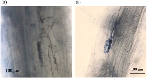 Figure 1. Morphological characteristics of endophytic and arbuscular mycorrhizal (AM) fungi in M. sinensis trypan-blue stained adventitious roots. (a) Microsclerotia and endophytic hyphae of dark septate endophytes; (b) Paris-type structure of AM fungi.