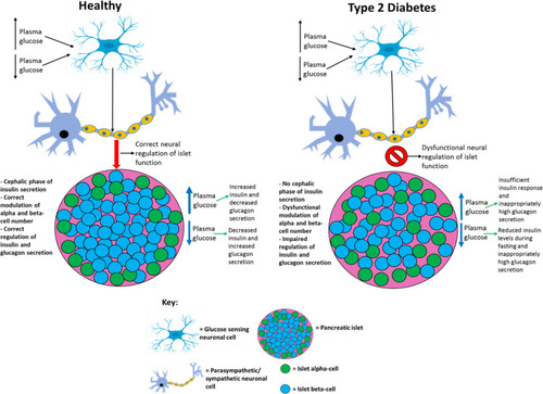 Figure 5 Comparing the differential neural regulation of pancreatic islets in healthy and type 2 diabetic individuals. T2D patients do not exhibit the cephalic phase of insulin secretion and based on the findings from studies it is possible that dysfunctional neuronal regulation of pancreatic islets contributes to the impaired GSIS, hyperglucagonemia, and decreased beta-cell proliferation and mass observed in this disease. This figure and information in its legend are with data adapted from these studies.Citation163,Citation166