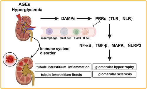 Figure 1 Immune cells are involved in DKD development.