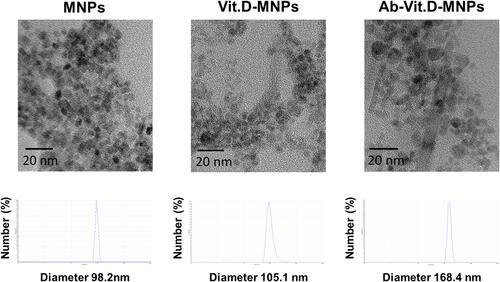 Figure 1 Characterization and size distribution of alginate-modified magnetic nanoparticles (alg-MNPs), vitamin D-loaded MNPs (Vit.D-MNPs), and Ab-Vit.D-MNPs by transmission electron microscopy (TEM) imaging and differential light scattering (DLS).