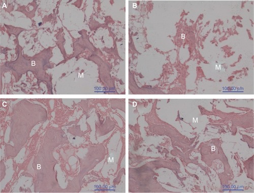Figure 9 Hematoxylin and eosin stained section of (A, C) nanofluorapatite (n-FA)/polyamide 12 (PA12) composite with 40 wt% n-FA and (B, D) PA12 implanted into bone defects of rabbit femora for (A, B) 4 weeks and (C, D) 8 weeks.Note: B represents new bone tissue and M represents gradually degraded materials.