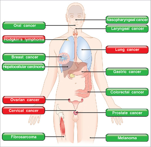 Figure 3. Roles of eosinophils in human and experimental tumors. In green boxes are indicated those tumors in which eosinophils play a protective role. In red boxes those tumors in which eosinophils play a pro-tumorigenic role. In mixed red/green boxes are presented tumors in which eosinophils play both a pro- and anti-tumorigenic role in different studies.