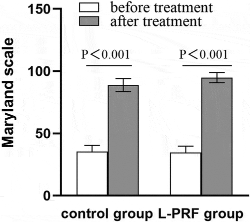 Figure 1. Comparison of Maryland scale between two groups of patients before and after treatment. P < .05, the difference is statistically significant. Before treatment: control group 35.36 ± 5.02; L-PRF group 34.52 ± 5.29,t = 0.513,p = .600; After treatment: control group 88.84 ± 5.22; L-PRF group 94.80 ± 4.14,t=−4.499,p＜.001.
