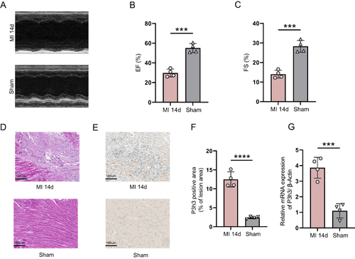 Figure 8 Cardiac function and validation of P3h3 gene. (A) Representative echocardiographic images. (B) Left ventricle ejection fraction (n = 4). (C) Left ventricle fractional shortening (n = 4). (D) Representative images of hematoxylin and eosin staining. Magnification 20×, scale bar = 100μm (n = 4). (E and F) Representative images and quantification of P3h3 immunohistochemical staining. Magnification 20×, scale bar = 100μm (n = 4). (G) The expression level of P3h3 by qRT-PCR (n=4). P-values were calculated using an unpaired Student’s T-test. ***P < 0.001; ****P < 0.0001.