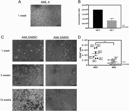 Figure 2. Human MSCs are more effective than murine MS-5 stromal cell line in maintaining AML cells. (A) Representative light microscopic picture (100×) of AML cells cultured for 7 days in liquid culture without feeder cells. (B) Absolute numbers of MNCs from samples AML1-4 after 7 days of liquid culture (n = 4, error bar = SEM). (C) Representative microscopic images (100×) of AML cells co-cultured for 12 weeks on MSC and MS-5 stromal cell line, respectively. (D) Absolute number of viable CD45+ AML cells from three patients, harvested after 12 weeks of co-culture with MSC (n = 3) and MS-5 stromal cell line (n = 3). Each dot and circle represents one individual experiment, legend indicates the AML and MSC cells used. Error bar = SEM.