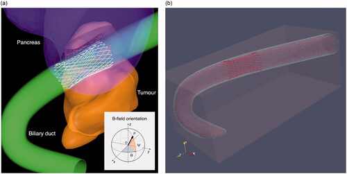 Figure 1. (a) Model of the bile duct (green) and tumor along with the detail of the 1D structure of the metallic stent. The angles identifying the stent axis are: ψ = 72.5° and θ = 0°. The orientation reference for admissible field directions is indicated in the inset. (b) Full computational model domain.