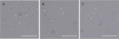 Figure 8. Overexpression of MeMinE proteins affect the normal division of E. coli. (A) Wildtype, BL21(DE3) at 0 μM IPTG. (B) Wildtype at 4 mM IPTG. (C) Cells transformed the plasmid pet30(a)-MeMinE at 4 mM IPTG. Scale bar represents 10 µm.