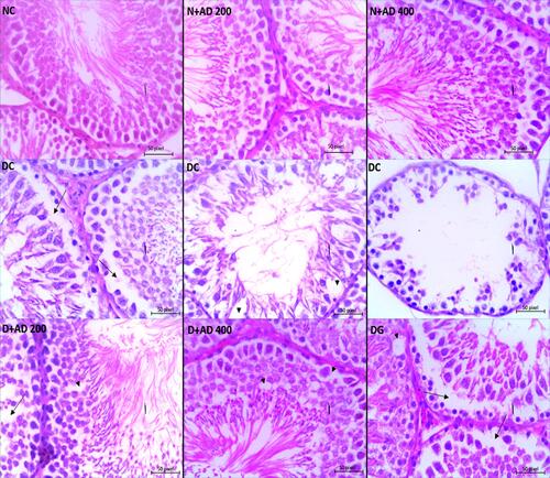 Figure 10 Light micrographs of the testes of normal and diabetic rats stained with hematoxylin–eosin (x400). The arrowhead reveals vacuolization within the germinal epithelium, the long arrow shows loss of germ cells and distorted spermatogenesis (40x Magnification).