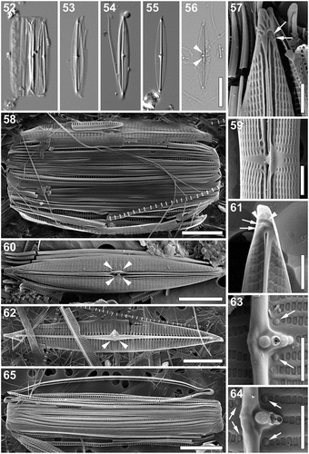 Figs 52–65. Proschkinia torquata. Figs 52–56. Light micrographs. Fig. 52. Specimen in girdle view with partially detached valve. Figs 53–56. Valve view. Arrowheads indicate the visible central raphe endings. Figs 57–64. Scanning electron micrographs. Fig. 57. External view of the apical part of the valve with several irregular areolae embedded within the terminal raphe fissure (arrows). Fig. 58. Frustule with partially detached valves. Fig. 59. Central part of the valve (external view). Fig. 60. External view of the valve. Fig. 61. Internal view of the apical part of the valve showing two small areolae (arrows) at the end of the curved thickening (arrowheads). Fig. 62. Internal view of the valve. Arrowheads indicate an elongated thickening of the central nodule extending laterally from the axial rib to the secondary side of the valve obscuring the central raphe endings. Figs 63, 64. Internal view of the central part of the valve with pores with rounded domed hymenes adjacent to each of the complete central striae on both sides of the raphe (arrows). Fig. 65. Detached girdle bands showing the transapically elongated pores on the internal side. Scale bars: Figs 52–56: 10 µm, Figs 58, 60, 62, 65: 5 µm, Figs 57, 59, 61, 63, 64: 1 µm.