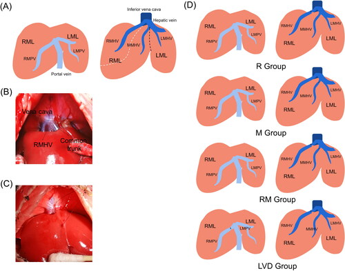 Figure 1. Schematic of the different rat models. (A) Portal (left) and hepatic (right) vein anatomy of the RML and LML are displayed, the dotted line indicated the boundaries of drainage areas of different HVs. (B) The second hepatic hilum of rat liver. The posterior vena cava, RMHV and common trunk were presented. (C) The MMHV were obstructed with suturing ligation, the needle entry and exit points were shown. (D) Schematics of the R, M, RM and LVD groups are described, respectively.